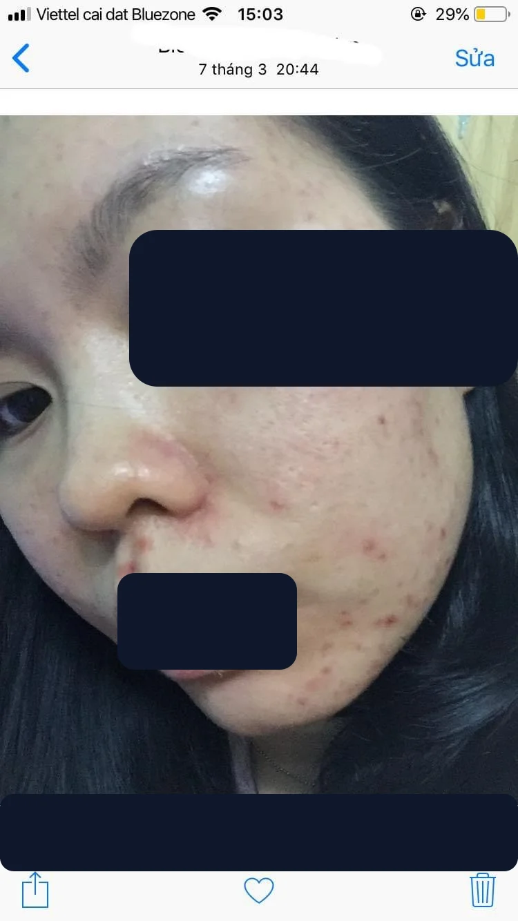 Bạn Phương Anh — trước
