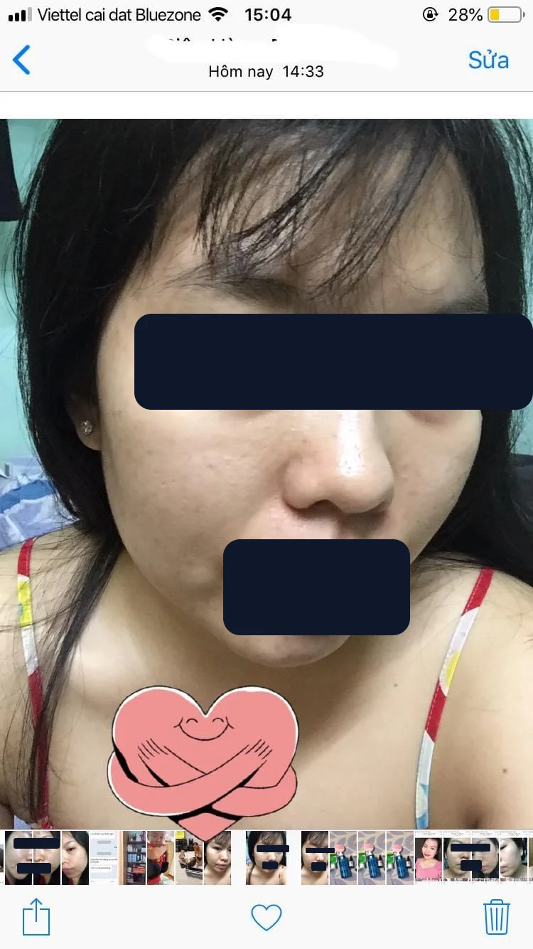 Bạn Phương Anh — sau