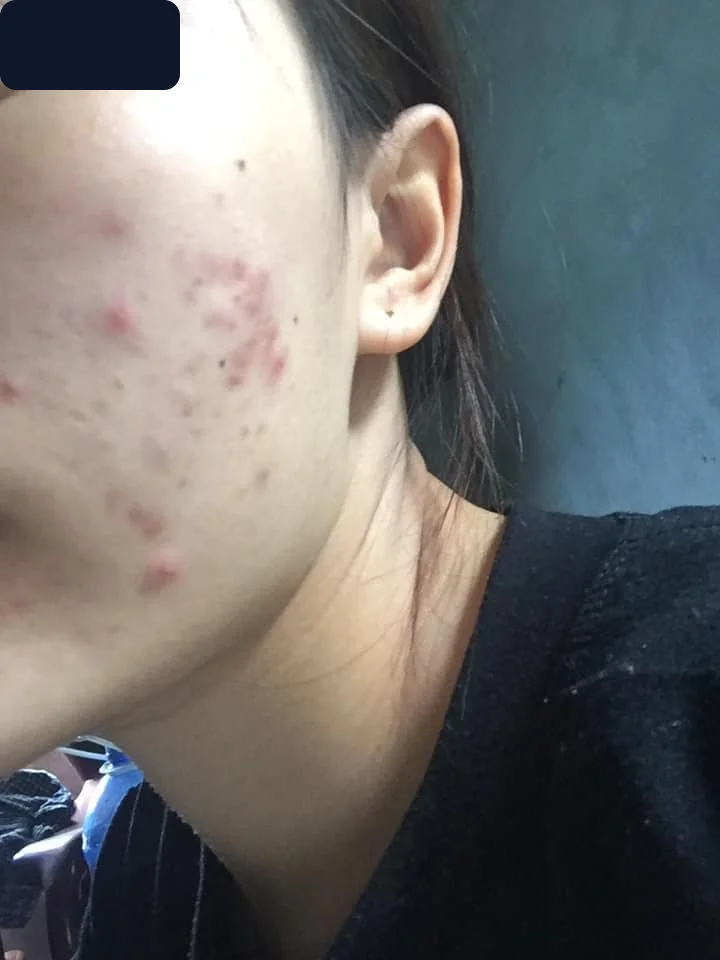 Bạn Hà Nguyễn — trước