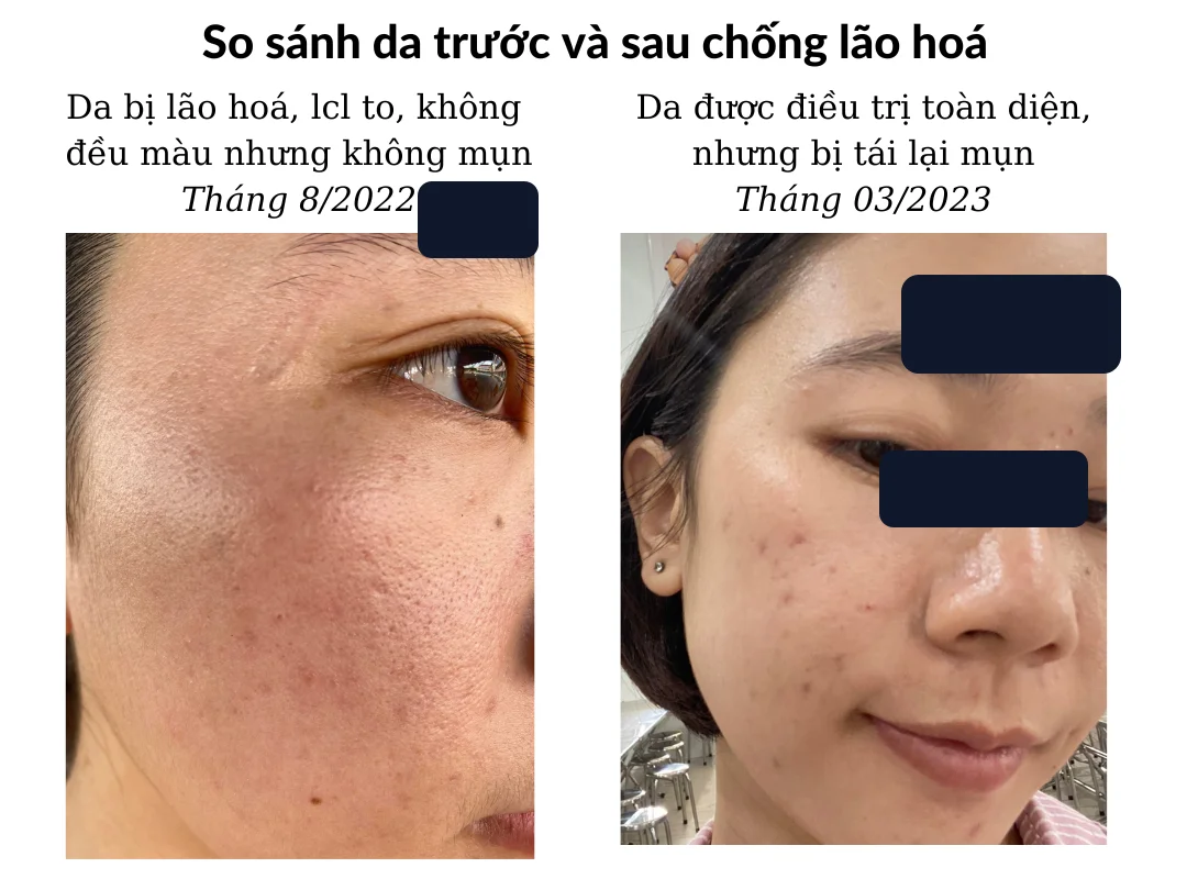 Một khách hàng — gần nhất