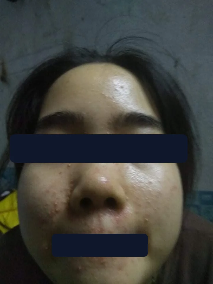 Bạn Hải Yến — trước