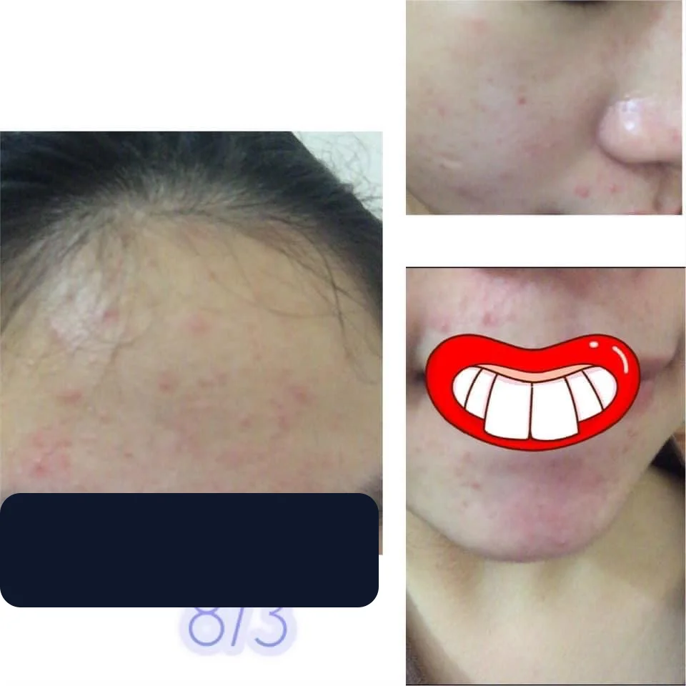Bạn Hạnh — trước