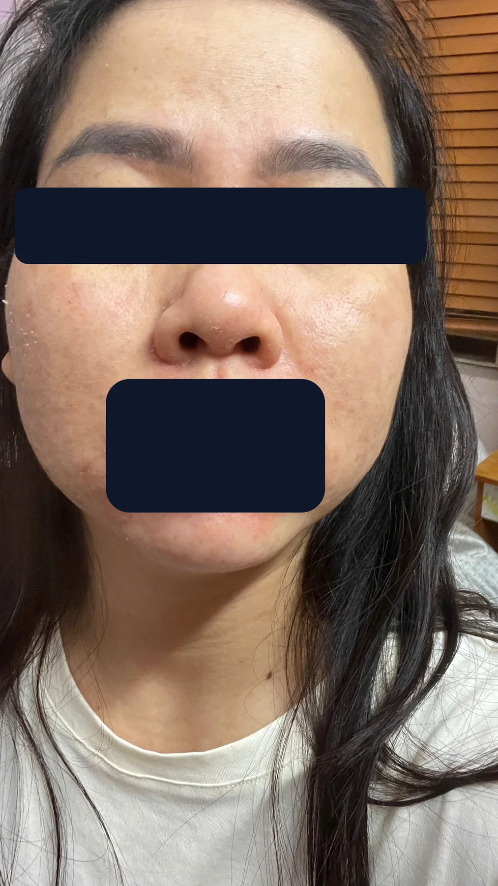 Chị Yến — sau