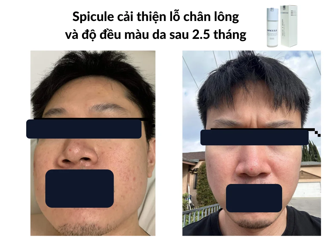 Một khách hàng — gần nhất