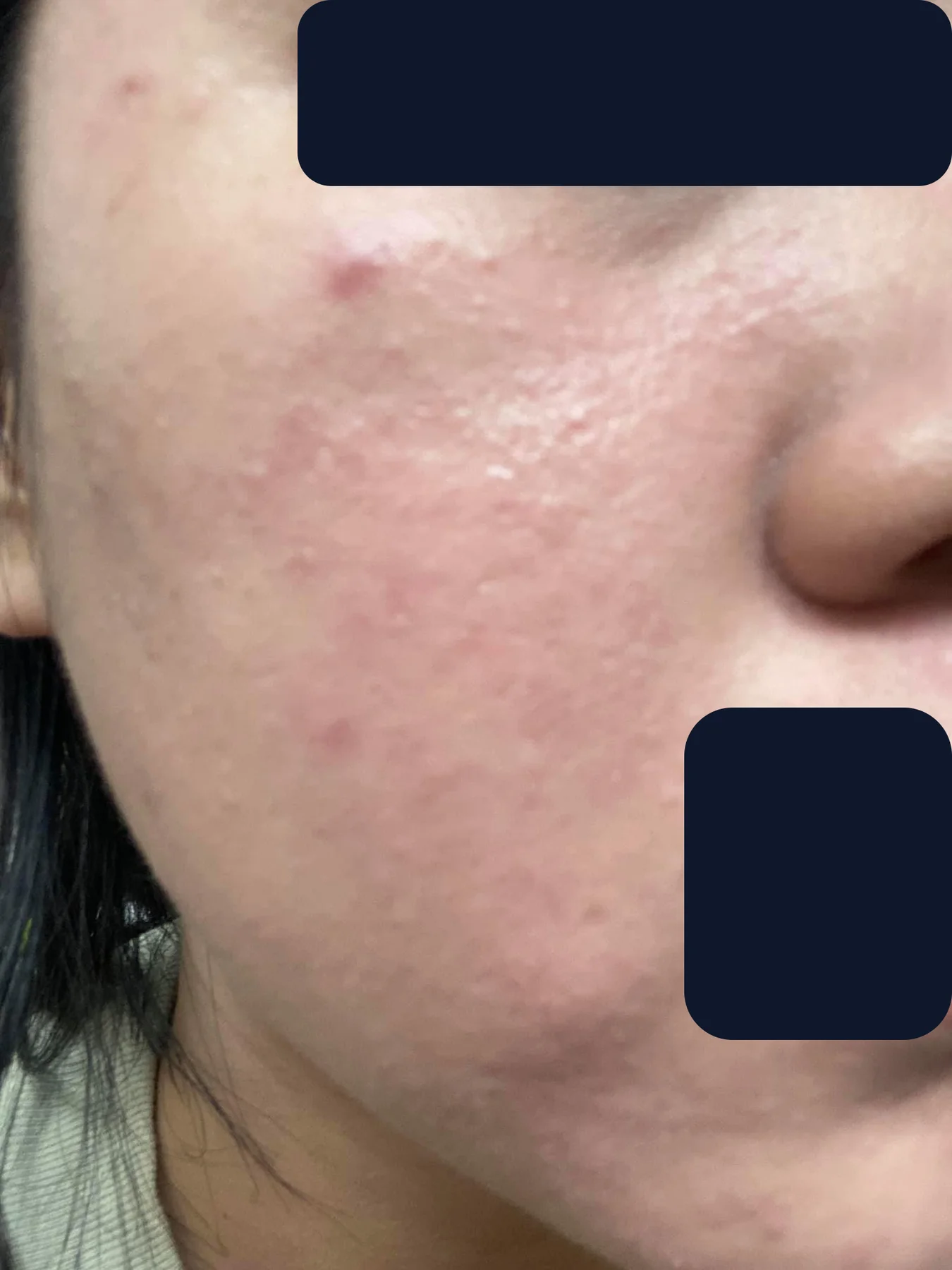 Bạn Hiền Hiền — trước