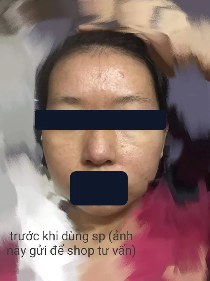 Một khách hàng — trước