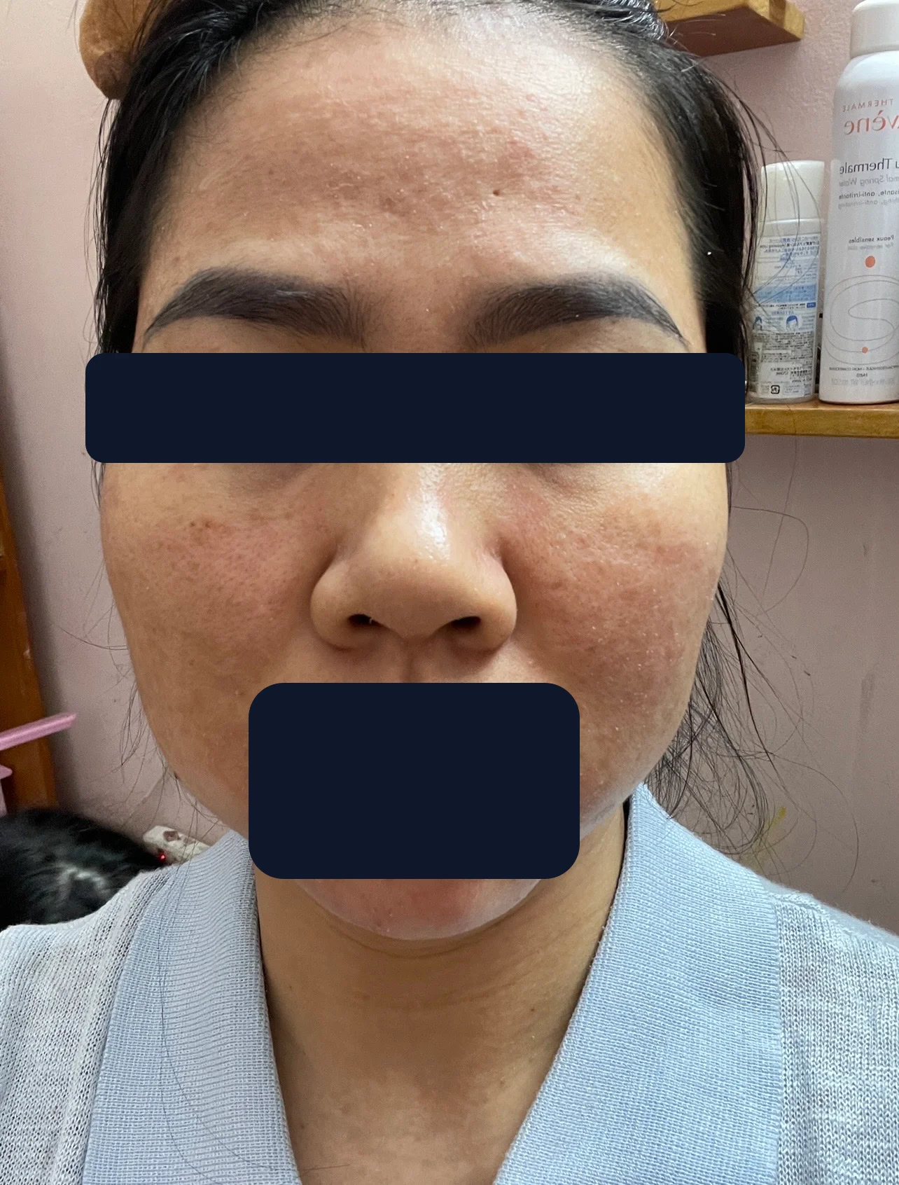Chị Yến — trước