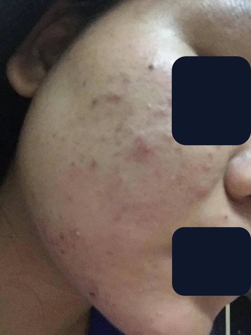 Bạn Thái Ly — trước