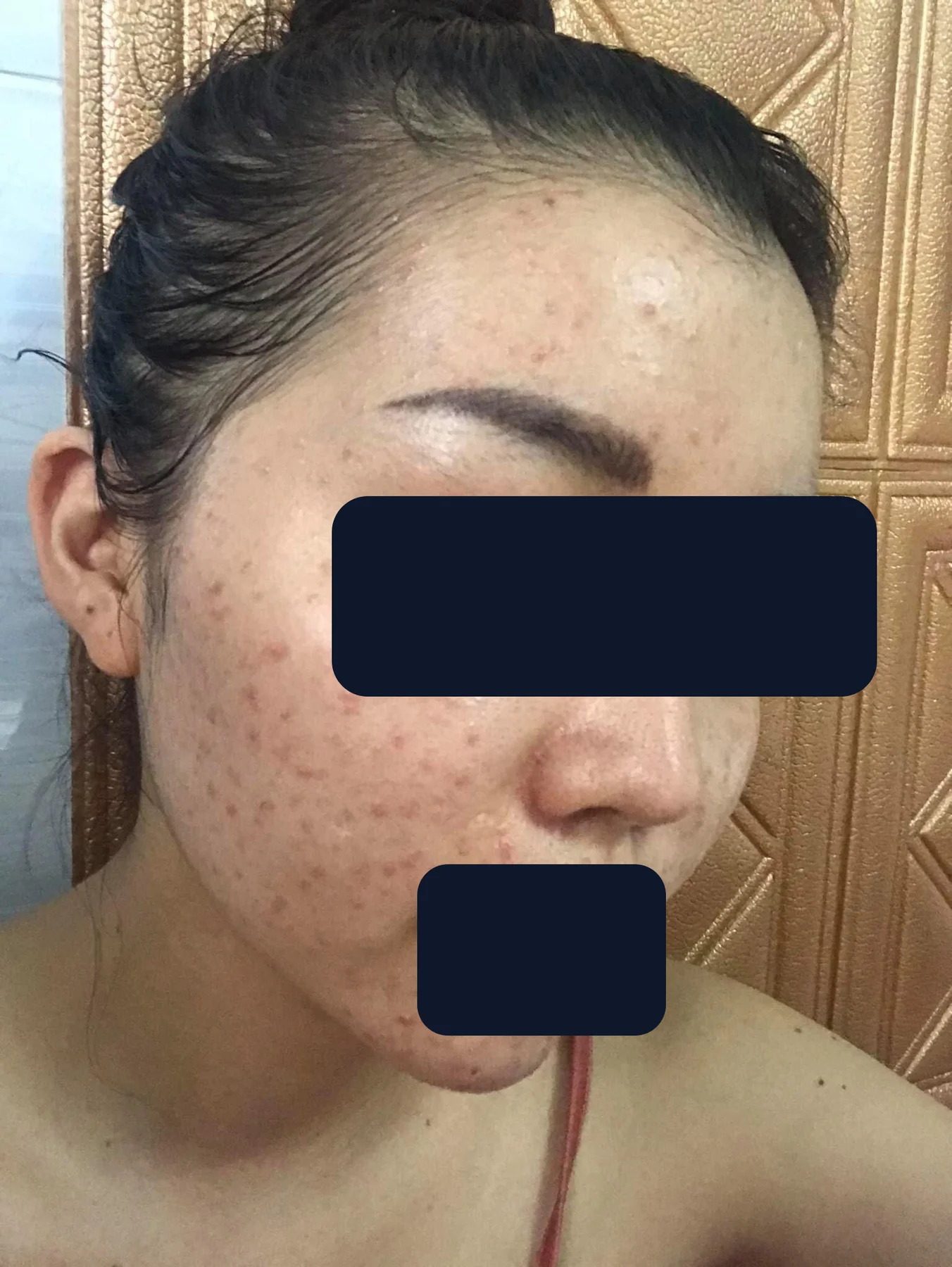 Chị Liên — trước
