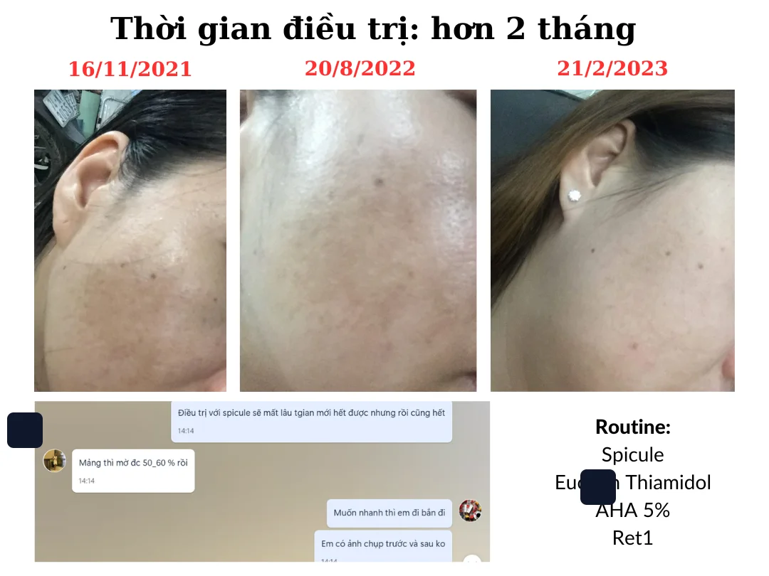 Một khách hàng — gần nhất