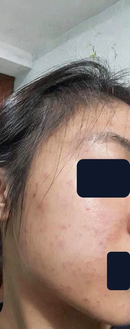 Bạn Vân Anh — trước