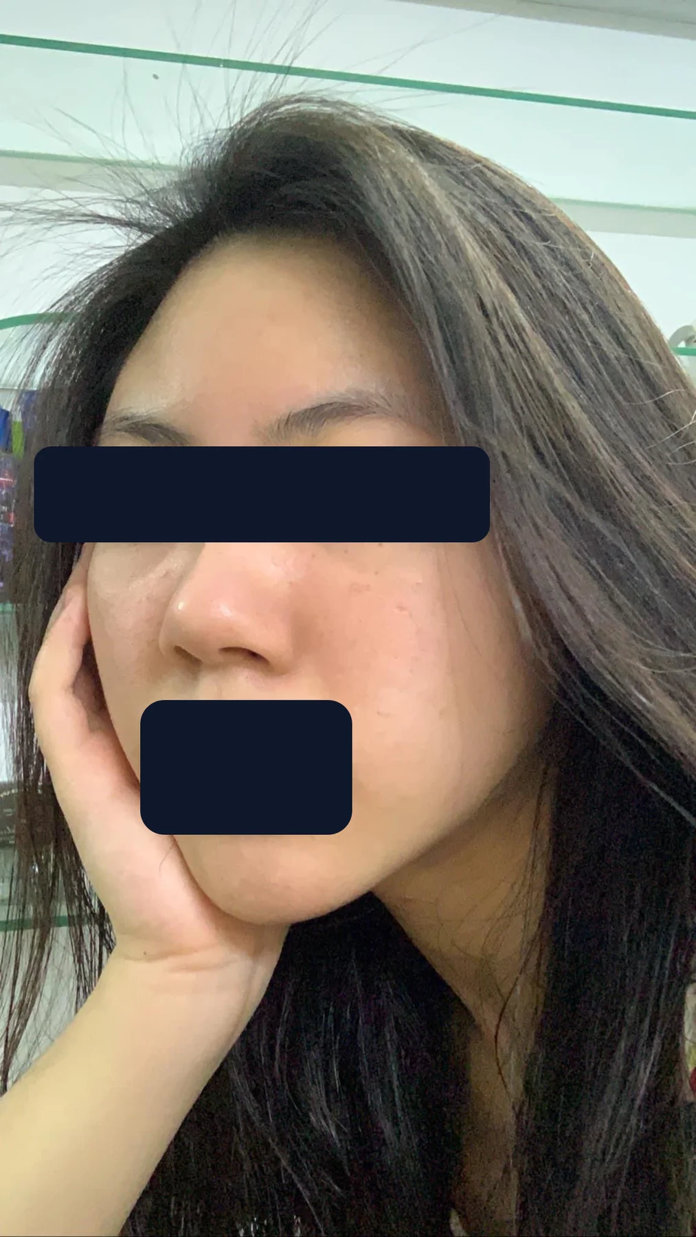 Bạn Vân Anh — sau