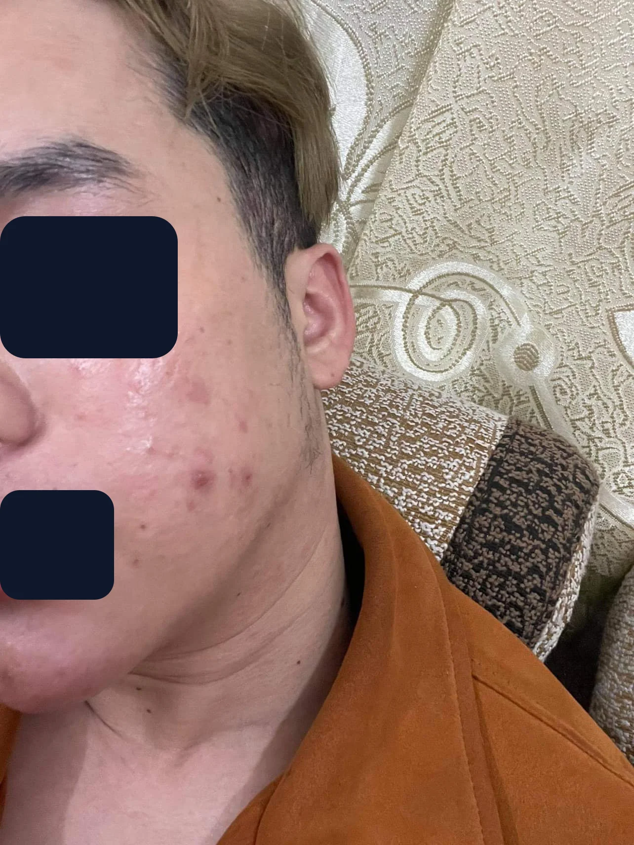 Anh Minh — trước