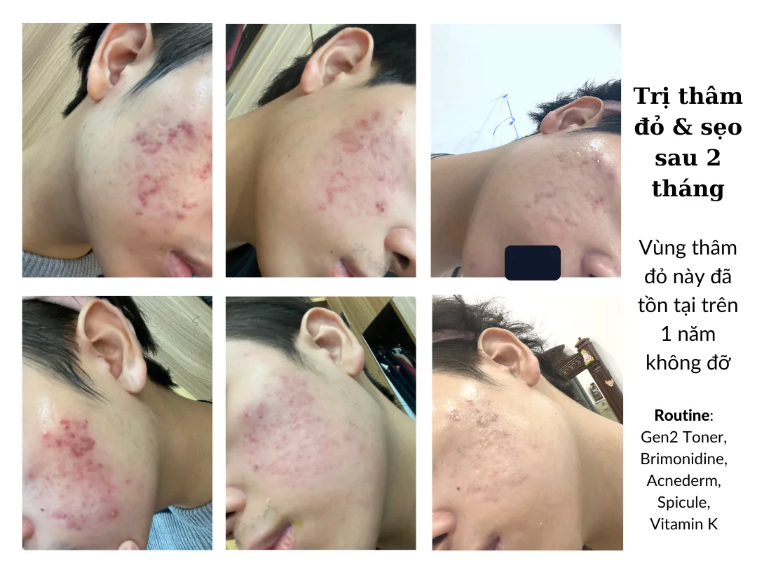 Một khách hàng — gần nhất