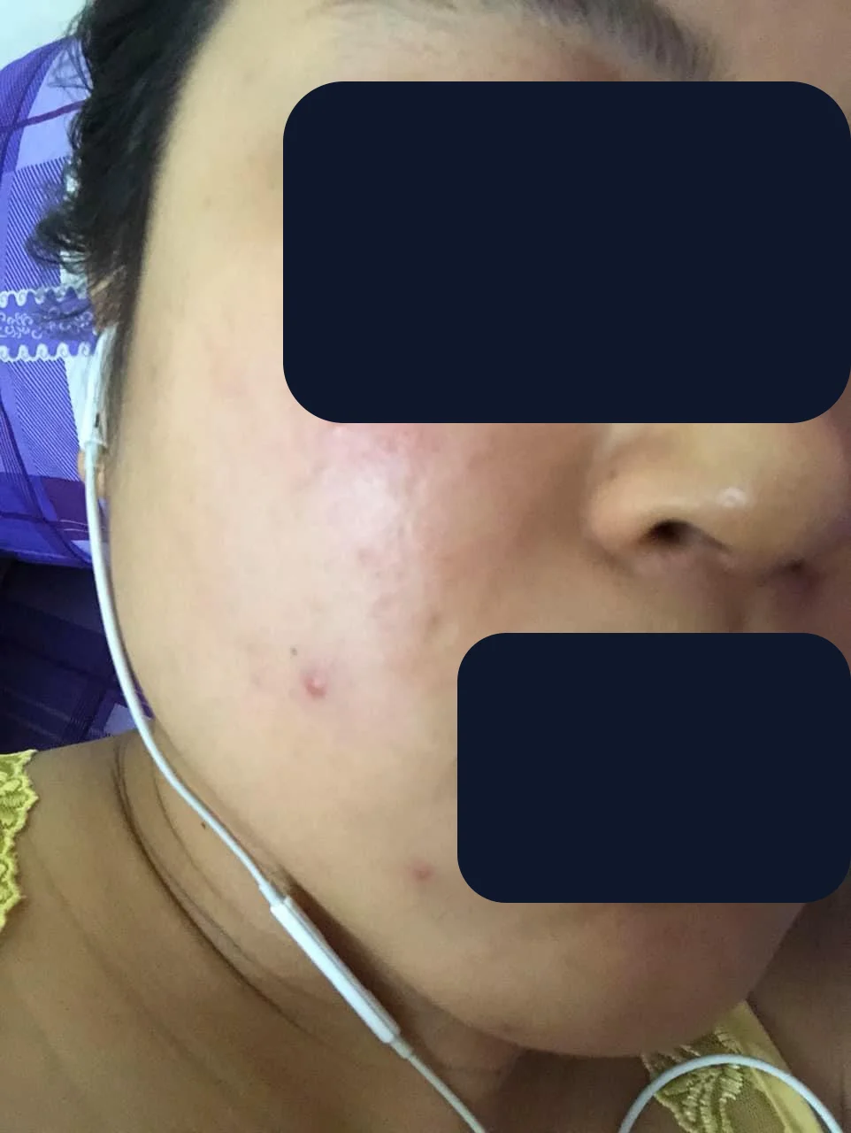 Chị Dạ Thảo — trước