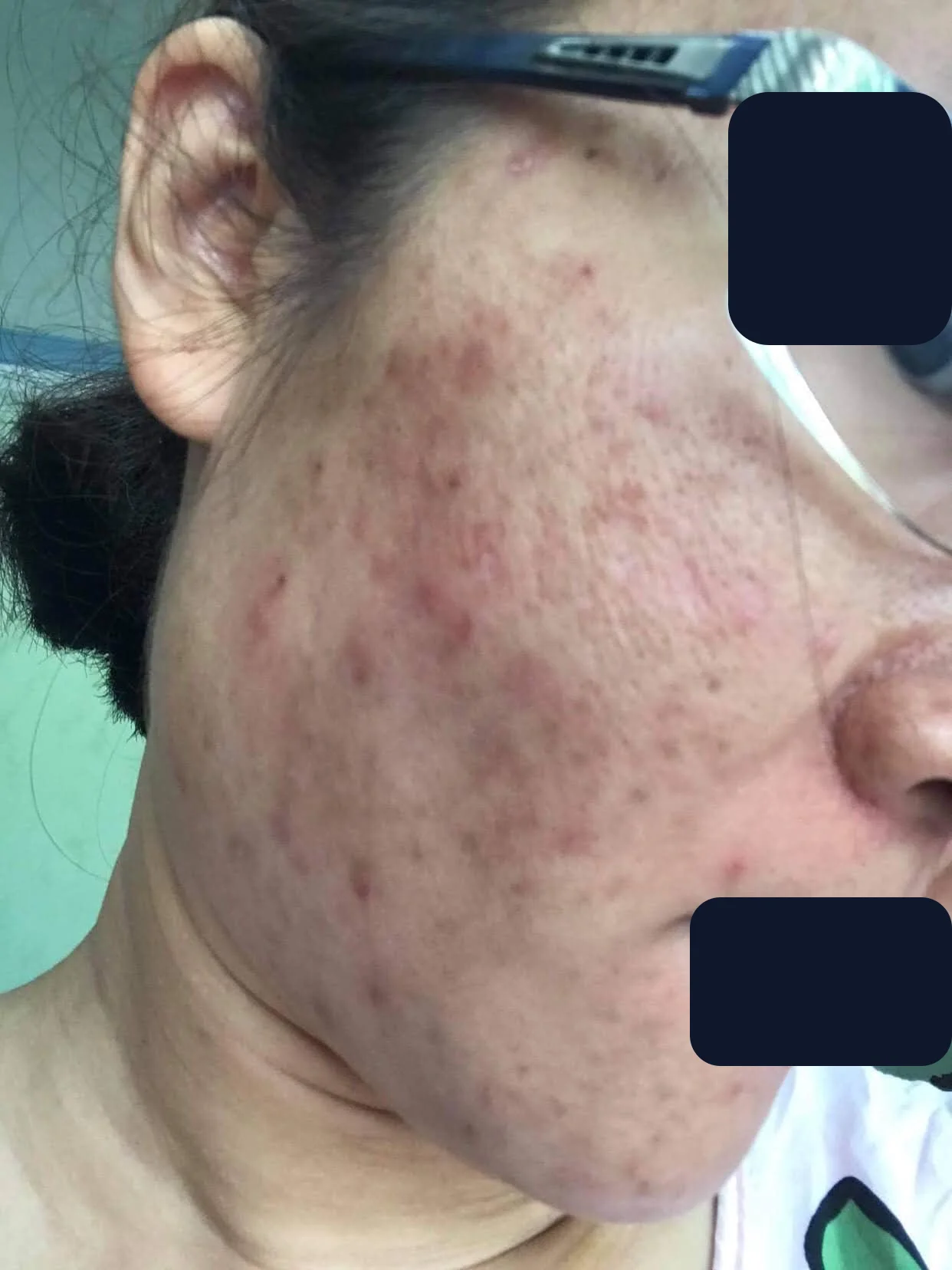 Bạn Bình Trần — trước
