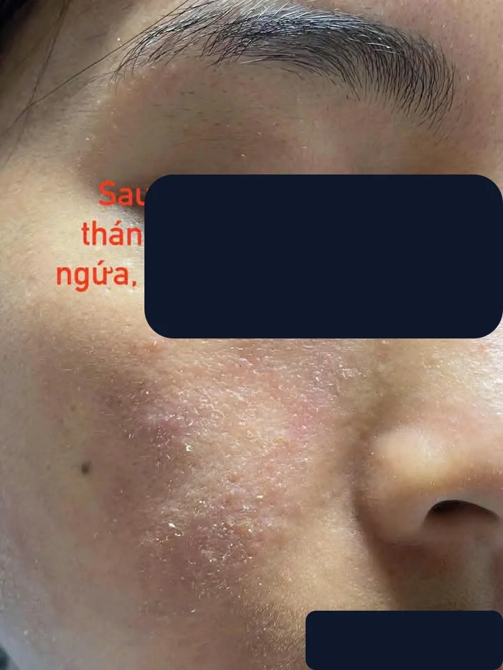 Chị My — trước