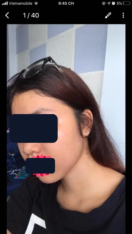 Bạn Ngọc Linh — sau
